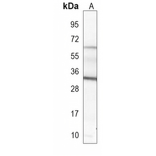 GDF15 Mouse Monoclonal Antibody(C3982)