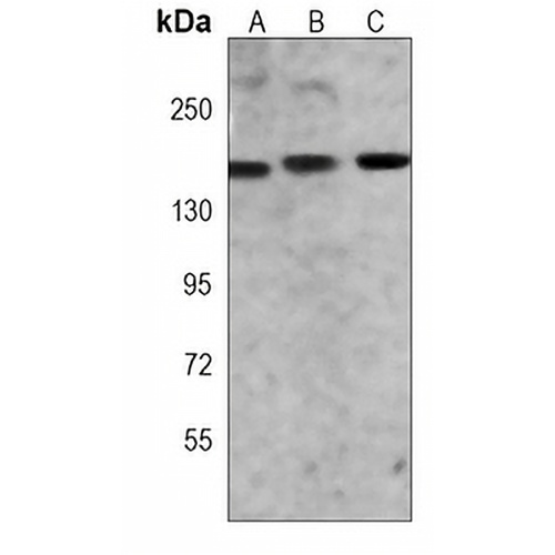 MYBBP1A Mouse Monoclonal Antibody(C3985)