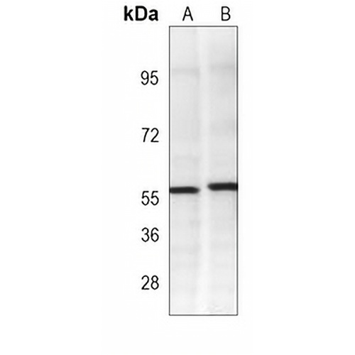 PINK1 Mouse Monoclonal Antibody(C3989)