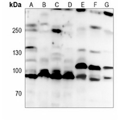 ACE2 Mouse Monoclonal Antibody(C3990)