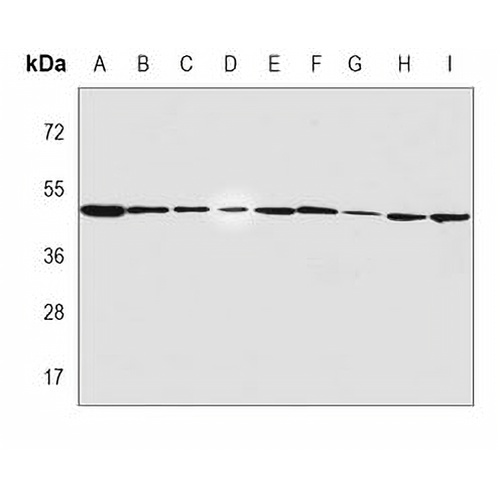 SHARP1 Mouse Monoclonal Antibody(C3993)