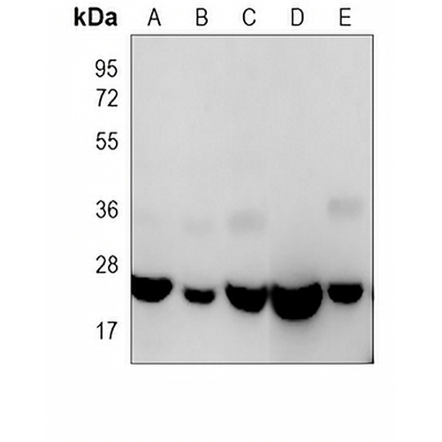 RAB1B Mouse Monoclonal Antibody(C3996)