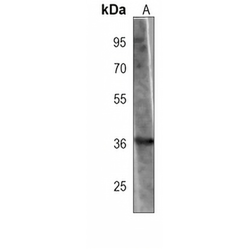 FN3K Mouse Monoclonal Antibody(C4000)