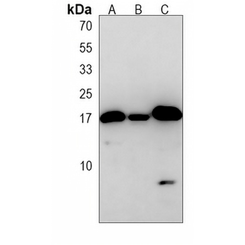 LC3A/B Mouse Monoclonal Antibody(C4001)