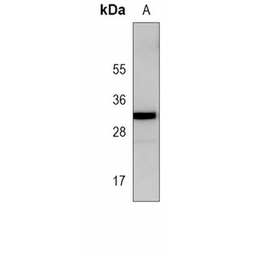 UBTD1 Mouse Monoclonal Antibody(C4008)