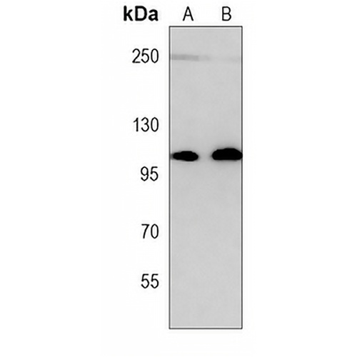 PRDM16 Mouse Monoclonal Antibody(C4010)