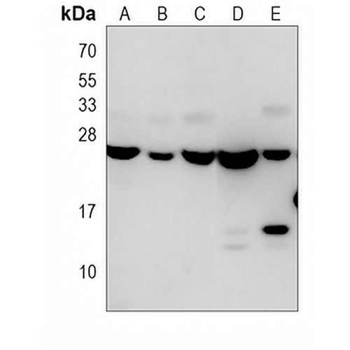 RAB18 Mouse Monoclonal Antibody(C4012)
