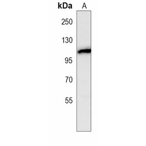 CYLD Mouse Monoclonal Antibody(C4014)