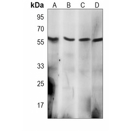 EIF2B3 Mouse Monoclonal Antibody(C4018)