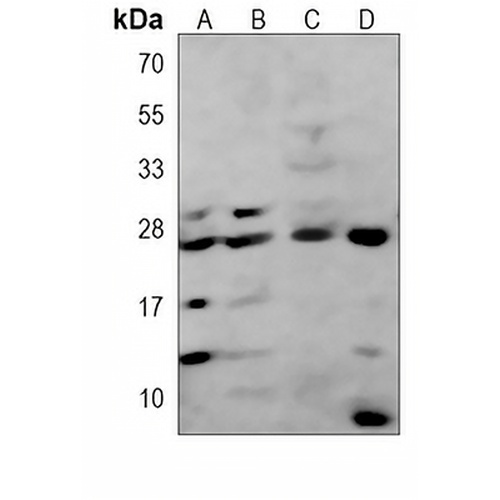 FGFR1OP2 Mouse Monoclonal Antibody(C4021)