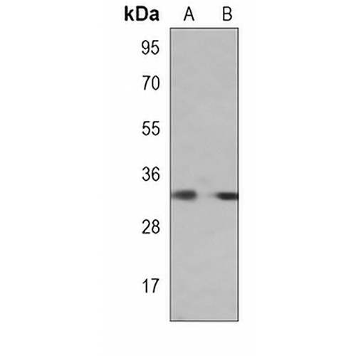 RAB20 Mouse Monoclonal Antibody(C4023)