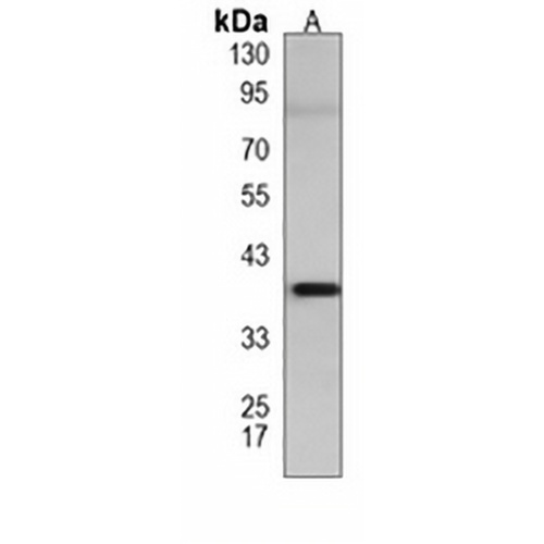 GDE1 Mouse Monoclonal Antibody(C4026)