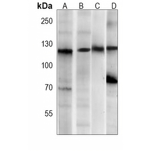 PERK Mouse Monoclonal Antibody(C4027)