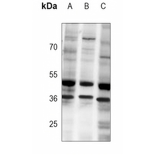 MBD2 Mouse Monoclonal Antibody(C4029)