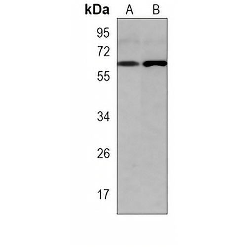 GLS2 Mouse Monoclonal Antibody(C4036)