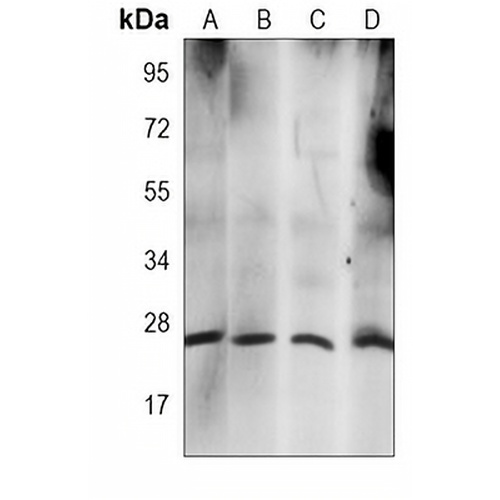 RAB21 Mouse Monoclonal Antibody(C4040)