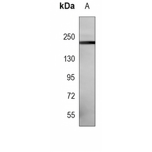 NOTCH3 Mouse Monoclonal Antibody(C4042)