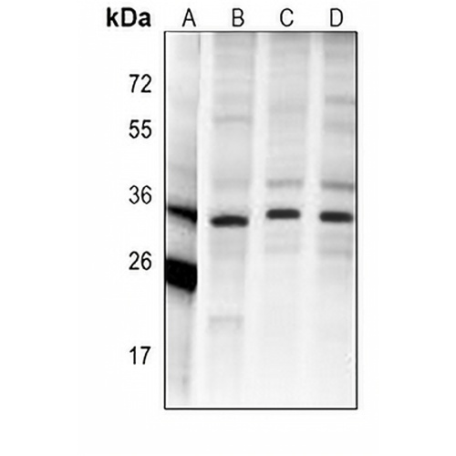 CHIP Mouse Monoclonal Antibody(C4044)