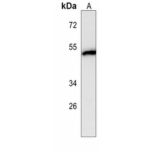 SNX6 Mouse Monoclonal Antibody(C4046)