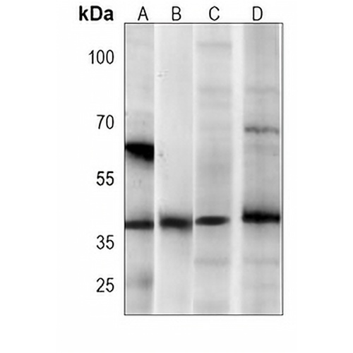 AMPK beta 1 Mouse Monoclonal Antibody(C4051)