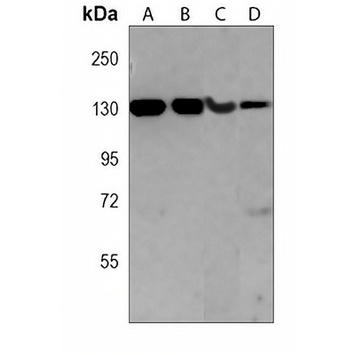 DNMT3A Mouse Monoclonal Antibody(C4058)