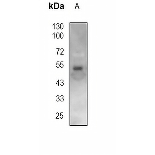 CD14 Mouse Monoclonal Antibody(3C10)