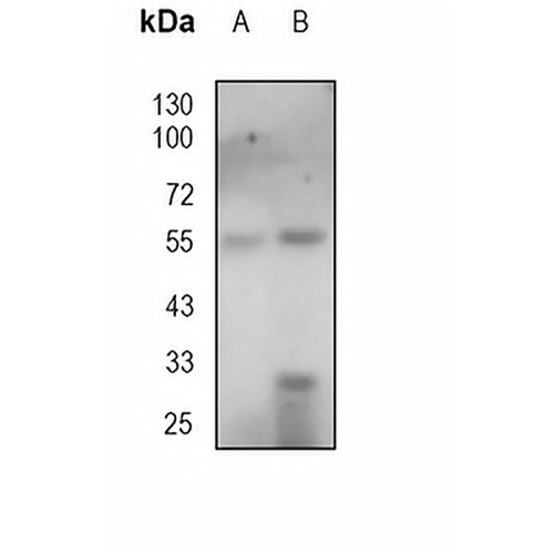 CD16 Mouse Monoclonal Antibody(CB16)