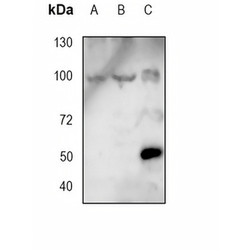 CD19 Mouse Monoclonal Antibody(CB19)