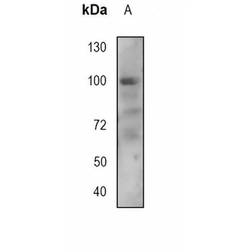 CD10 Mouse Monoclonal Antibody(CB-CALLA)