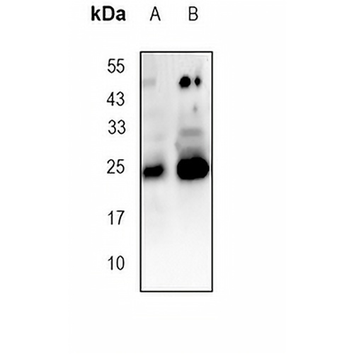 CD9 Mouse Monoclonal Antibody(HI9a)