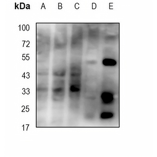 CD25 Mouse Monoclonal Antibody(JM7B6)