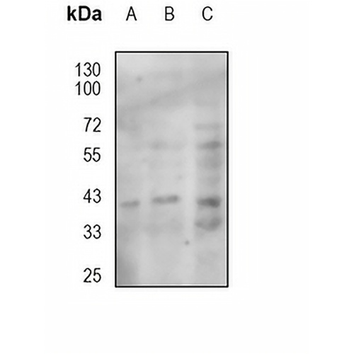 CD326 Mouse Monoclonal Antibody(VU-1D9)