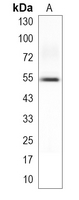 HNF4 alpha Rabbit Monoclonal Antibody(C4070)