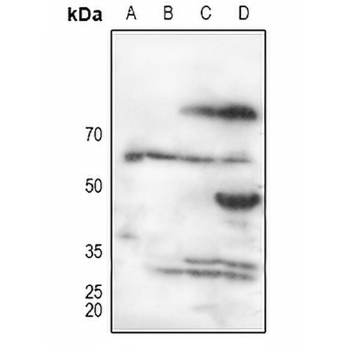 Alpha 1B glycoprotein Rabbit Polyclonal Antibody