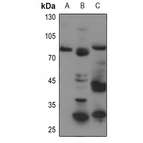 ABCB7 Rabbit Polyclonal Antibody
