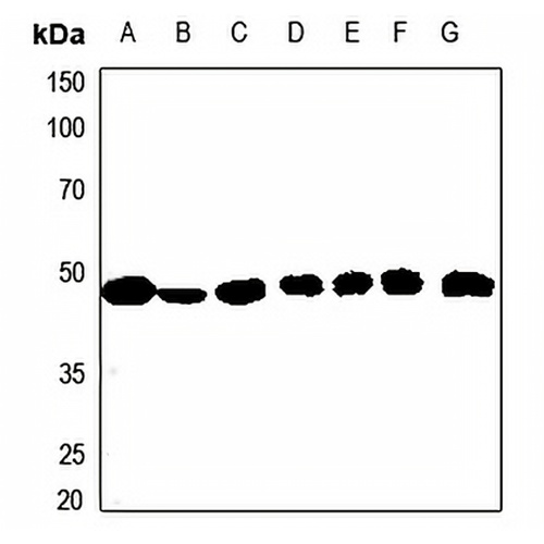 ACAT1 Rabbit Polyclonal Antibody