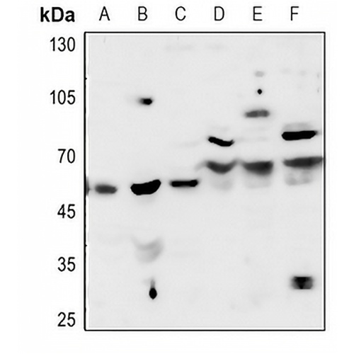 Acetylcholinesterase Rabbit Polyclonal Antibody