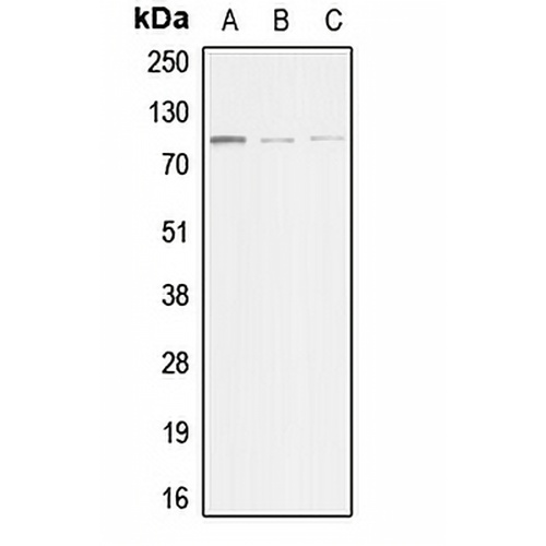 ACTN3 Rabbit Polyclonal Antibody