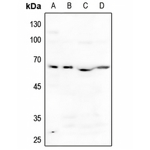 ACVR1B Rabbit Polyclonal Antibody