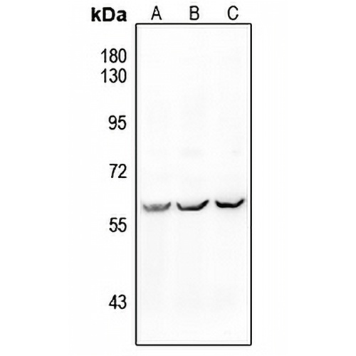 ALK1 Rabbit Polyclonal Antibody
