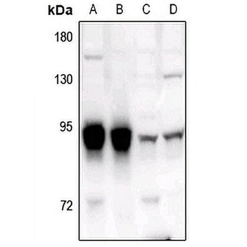 ADAR2 Rabbit Polyclonal Antibody