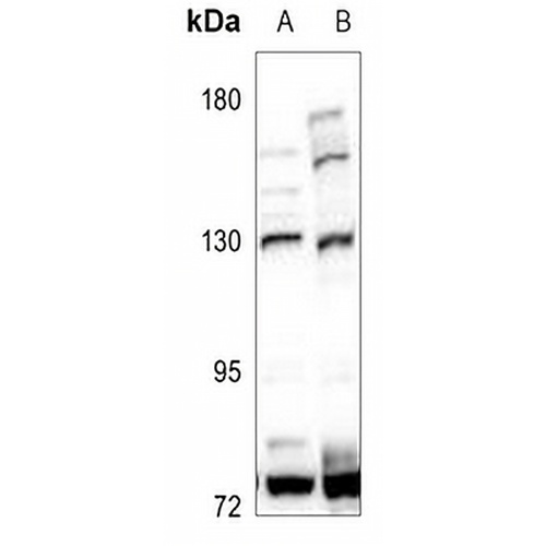 Adenylate Cyclase 1 Rabbit Polyclonal Antibody