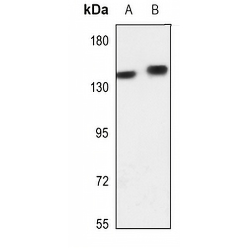 Adenylate Cyclase 5/6 Rabbit Polyclonal Antibody