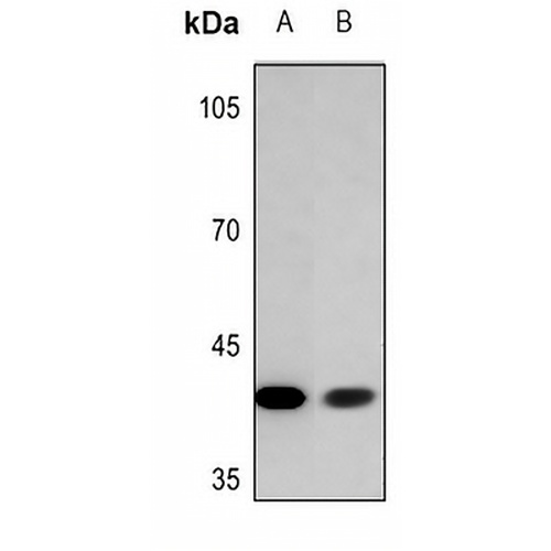 ADH7 Rabbit Polyclonal Antibody