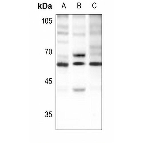 Beta-2 Adrenergic Receptor (Phospho-S346) Rabbit Polyclonal Antibody