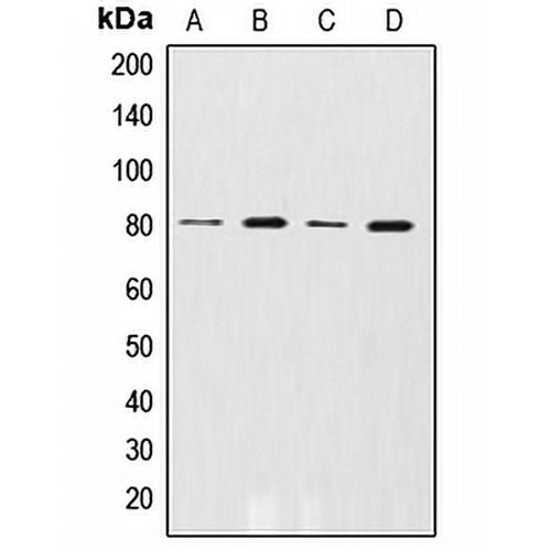 GRK2 (Phospho-S29) Rabbit Polyclonal Antibody