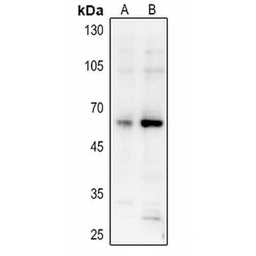 AKT (Phospho-S473) Rabbit Polyclonal Antibody
