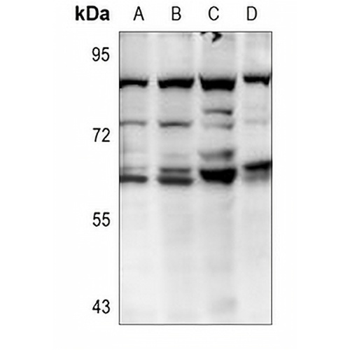 AKT2 Rabbit Polyclonal Antibody