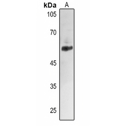 ALDH2 Rabbit Polyclonal Antibody