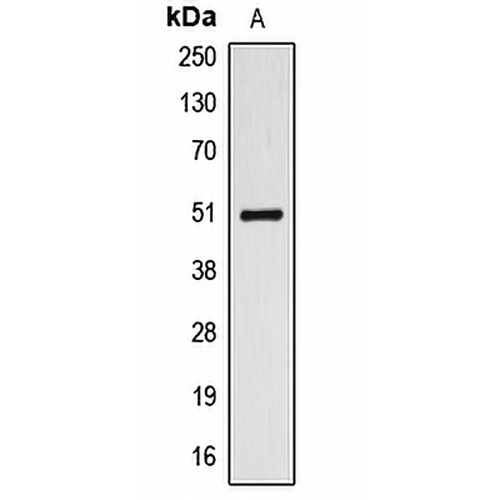 ALDH3A1 Rabbit Polyclonal Antibody